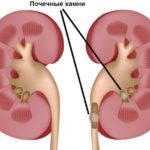 Кашель озноб температура чихание насморк головная боль