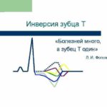 Лазерная абляция мочевого пузыря при лейкоплакии