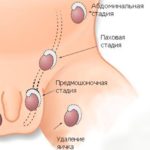 Боль в яичниках на 9 день цикла