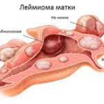 Маммография на ранних сроках беременности