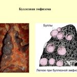 Боль в груди в середине цикла