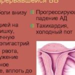 Киста верхней челюсти