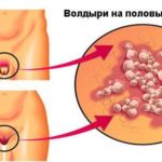 Курантил при низкой плацентарности