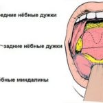 Болит попа у ребенка, когда сходит по большому